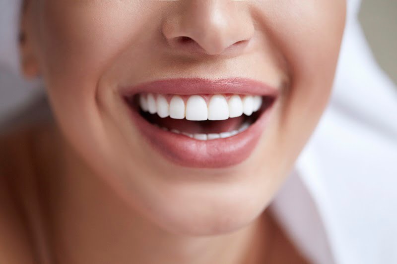 Czy wybielanie zębów jest bezpiecznie? Fakty i mity