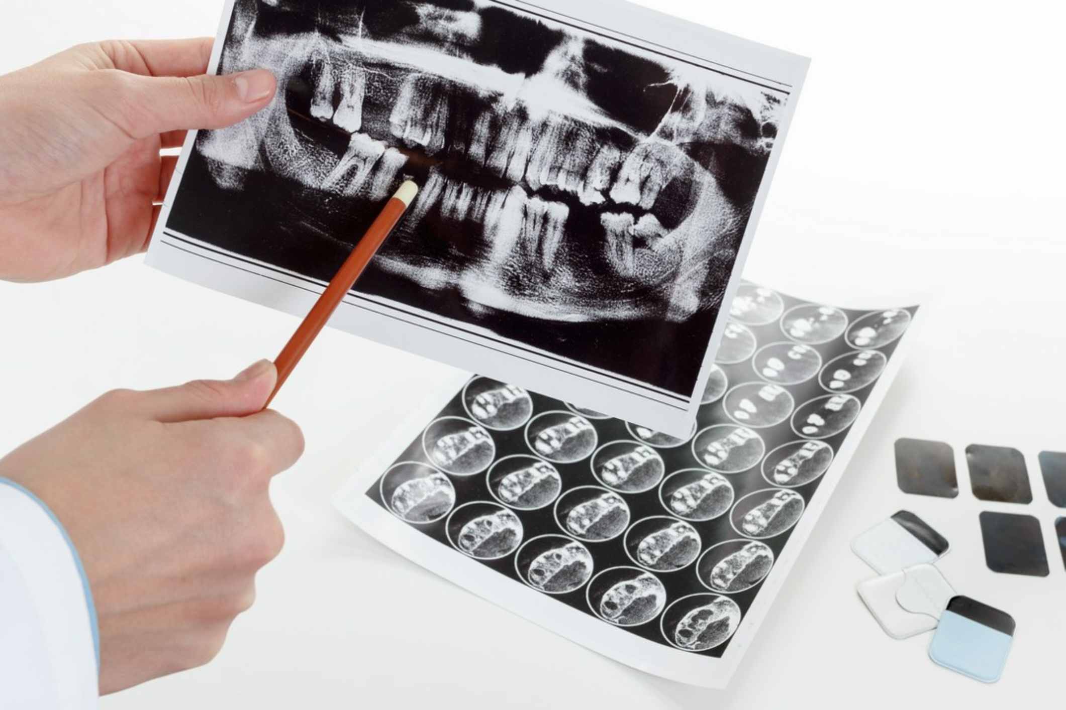 Jakie badania wykonać podczas diagnostyki chorób jamy ustnej?